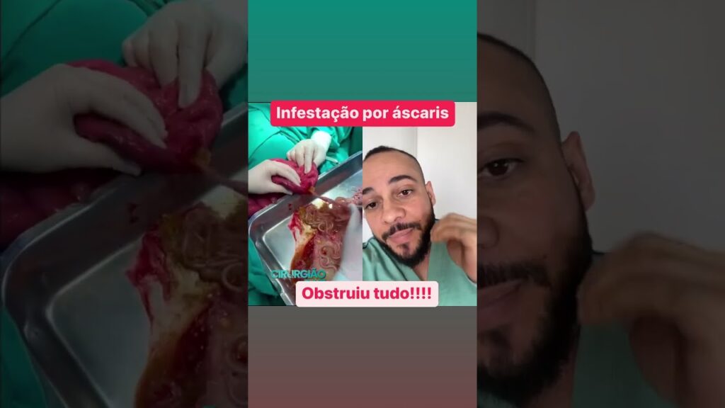 Como usar o app gafanhoto para ver promocoes de diversas lojas 1