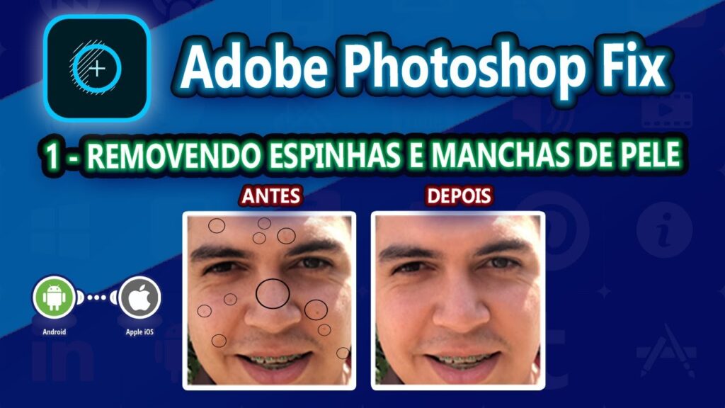 Como remover espinhas e manchas em fotos com o photoshop fix 1