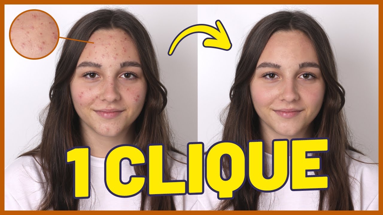 Como remover espinhas no photoshop com apenas alguns cliques 1